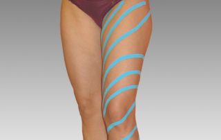 Frau mit spiralförmigem Tape am Bein und weiteren Tapes am Bauch