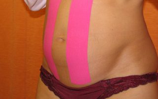 Schwangere Frau mit zwei senkrechten Tape-Streifen auf dem Bauch