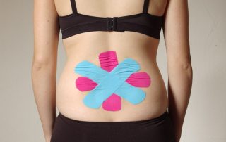 Frau mit vier kreuzförmig angelegten Tape-Streifen auf dem Rücken