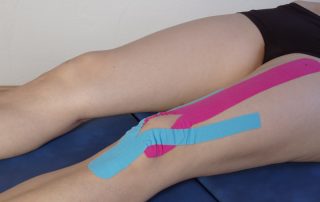 Frau mit zwei verschiedenen Tapes auf Oberschenkel und Knie