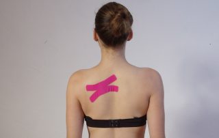 Frau mit X-Tape im Bereich des oberen Rückens