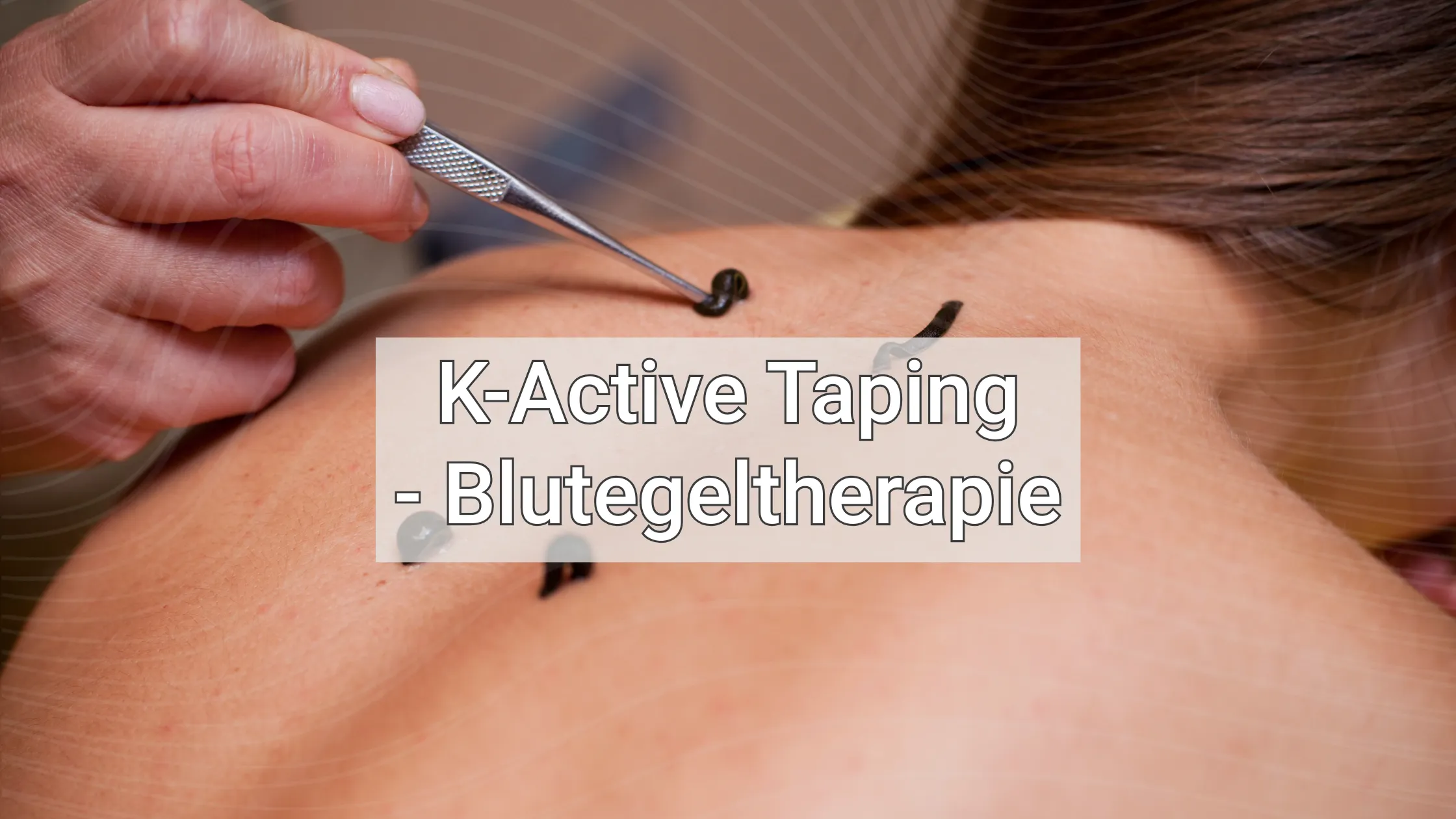 blutegeltherapie