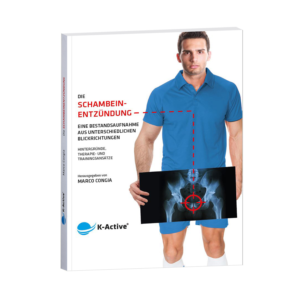 ShopbildjpiK3E34OTwRZ Die Schambeinentzündung