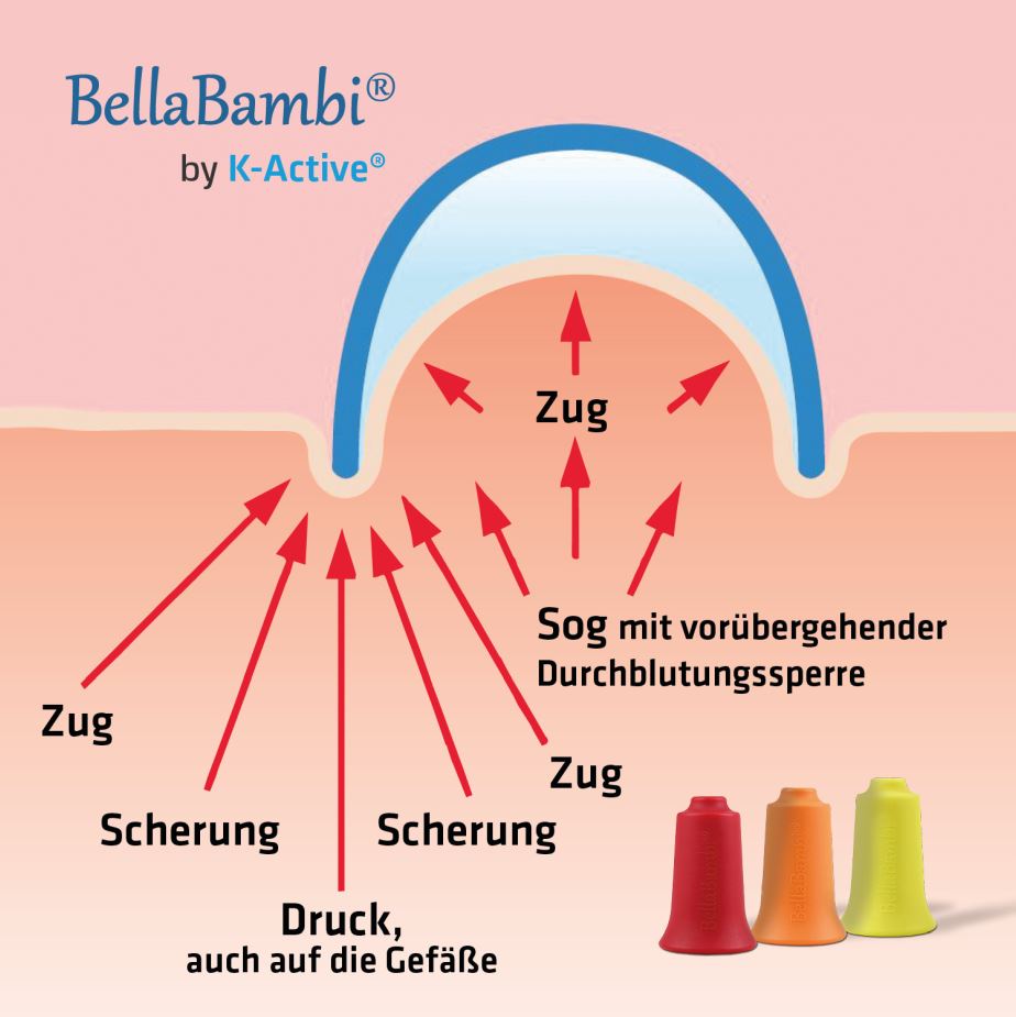 K-Active_BellaBambi_Grafik