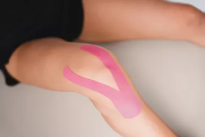 Patella Patella