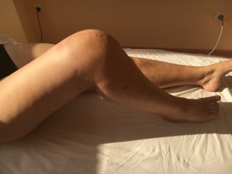 Knie eines Patienten