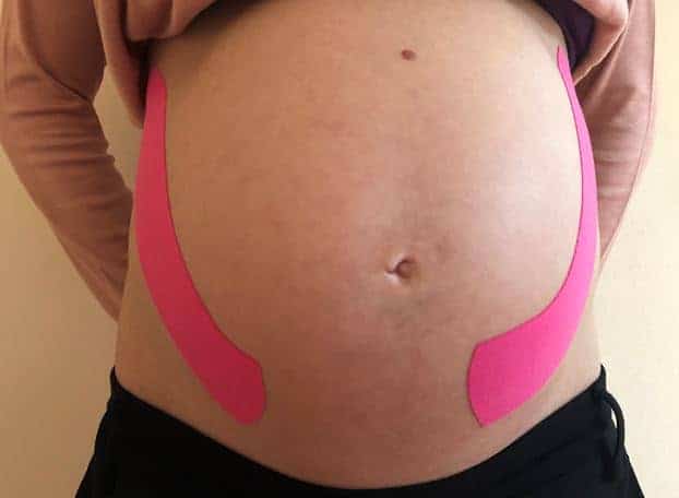 Schwangere mit Tape an beiden Seiten des Bauchs von vorne