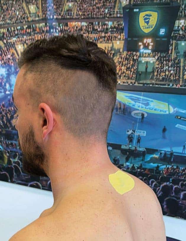 Vita Chip mit Tape im Nacken